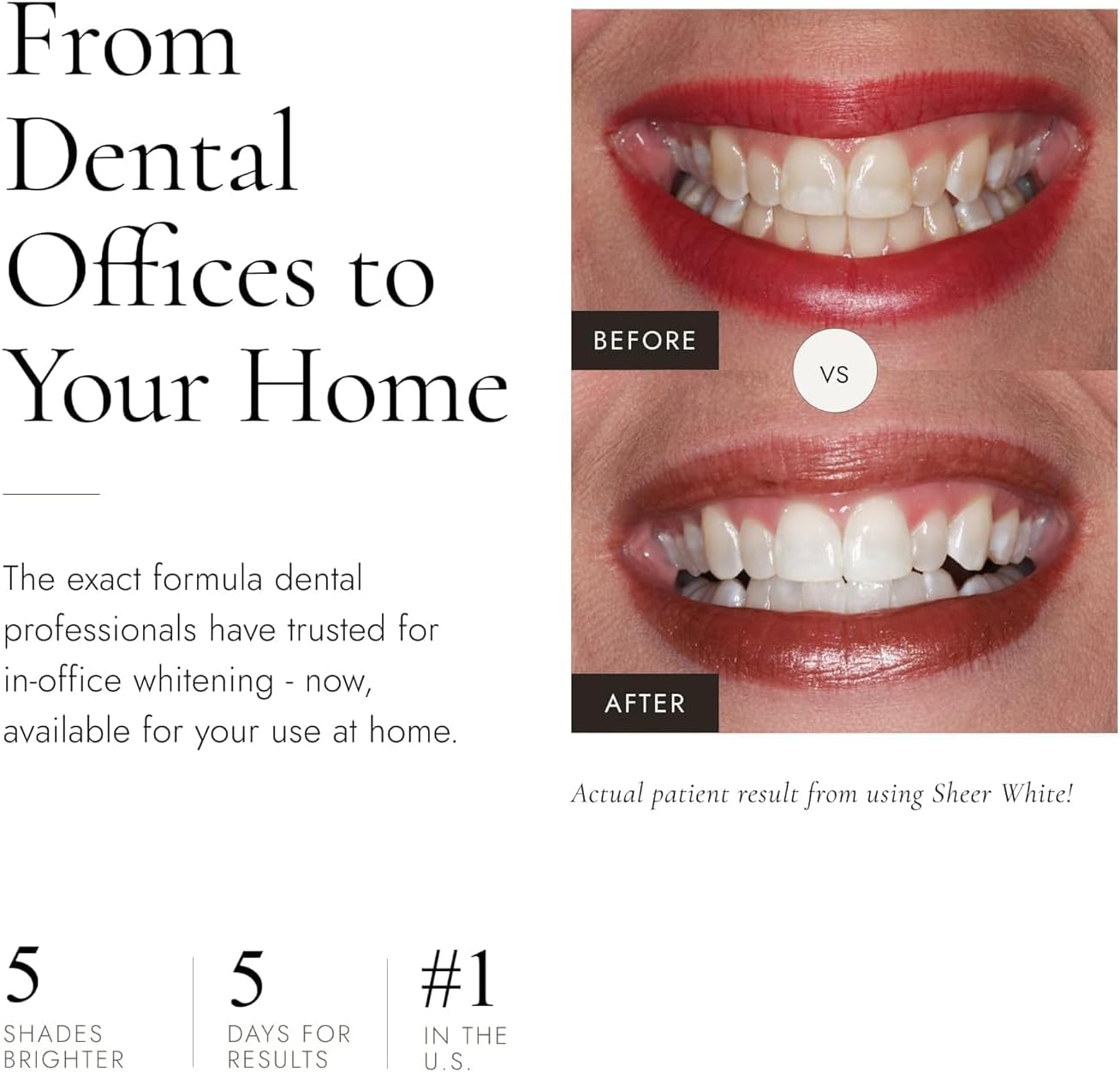 Sheer White! Take-Home Whitening